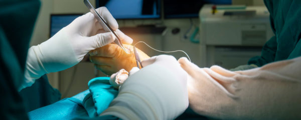 Chirurgie mini-invasive du pied