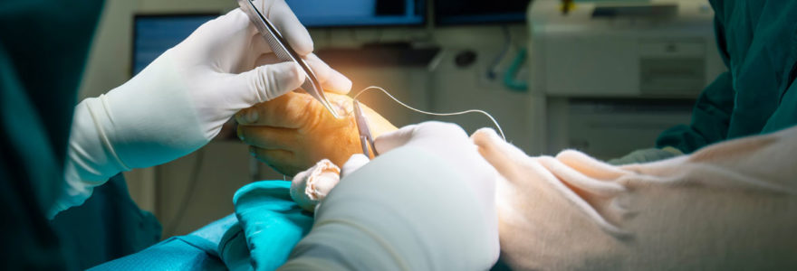 Chirurgie mini-invasive du pied